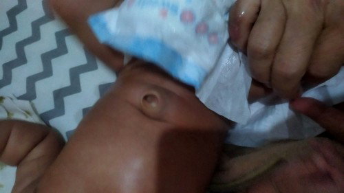 Bentuk pusar