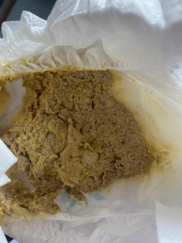 Najis susu formula