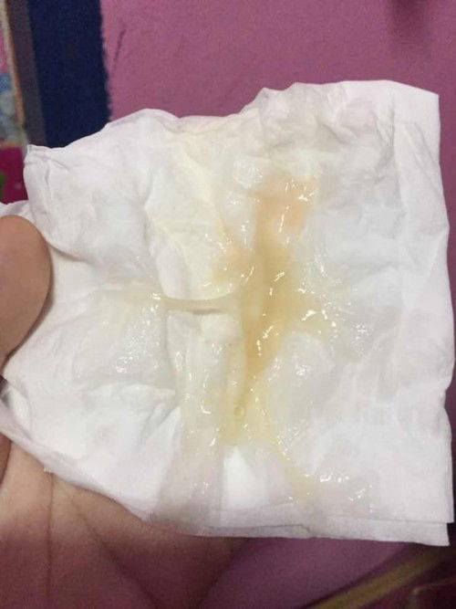 ใกล้คลอดยังงค่ะะ