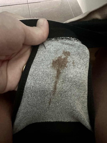 ท้อง3เดือนมีเลือดออก