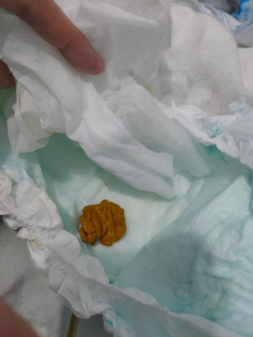 Ask ko lng po kung may nakaencounter na ng ganito turning 8months si baby and nagssolid food na siya