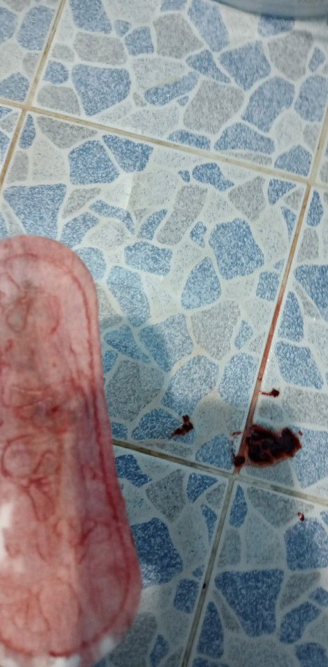 เลือดไหลมาเยอะ