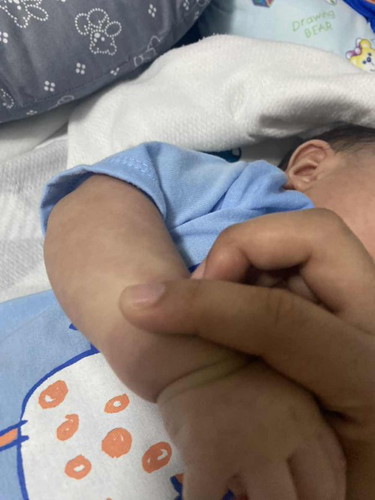 Mga momsh ano po kayo tu di po kasi pantay skin color ng baby ko , ano po kaya to?
