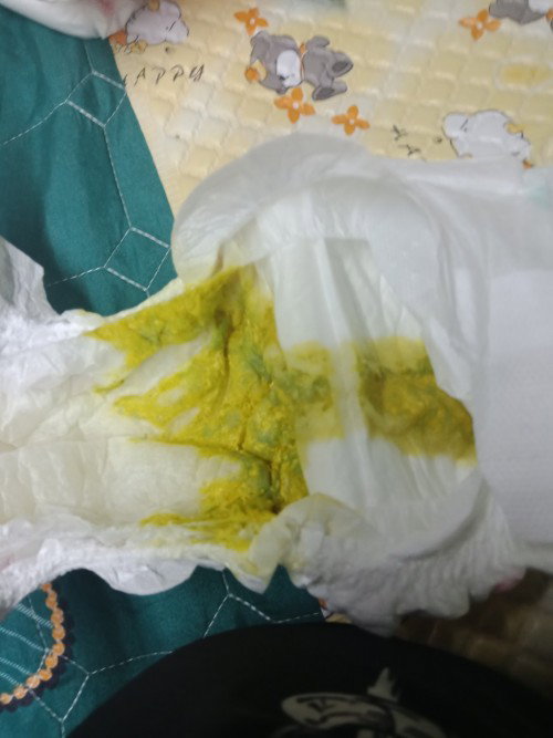 ลูกอึสีนี้