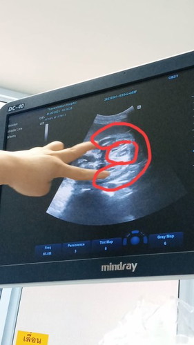 เพศอะไรคะใครดูออก