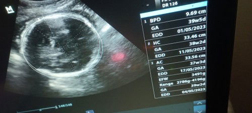 Mulai deg degan bun ☺☺