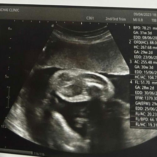 แม่ๆเห็นเป็นเพศอะไรกันคะ