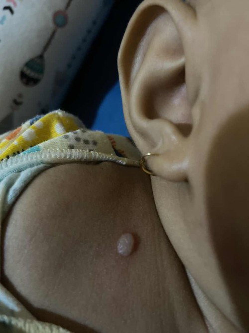Kulit bayi kenapa?
