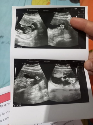 อยากทราบเรื่องเพศลูก