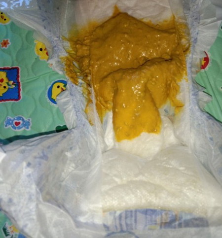 Poop ni Baby (Pasintabi sa larawan)