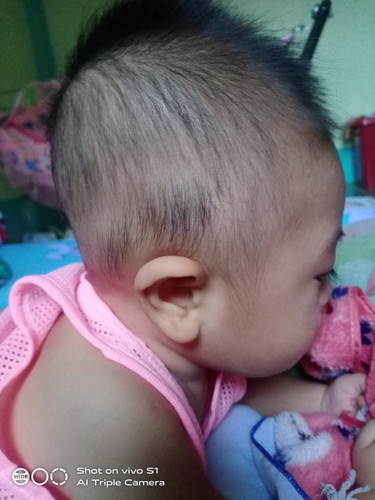 แบบนี้น้องหัวแบนไหมคะ