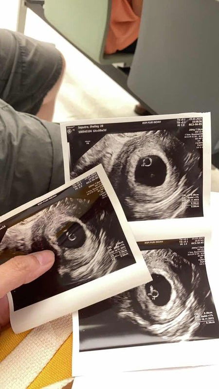 Proses penyembuhan dari keguguran