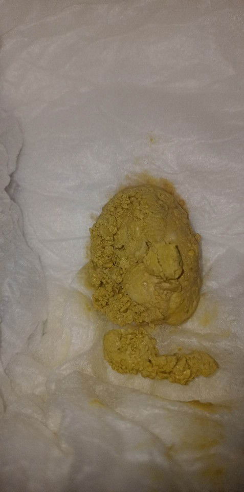 Matigas na poop ni baby