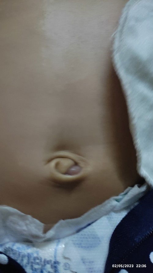 Saya nak tanya mmg pusat akn jdi mcm tu ke?skrg ank 2 bulan.