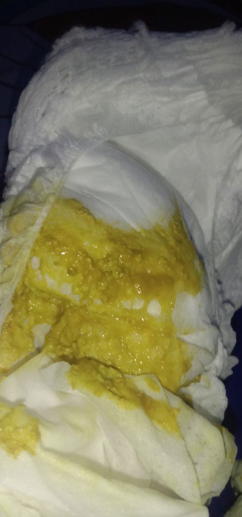 Pup bayi 4bulan 25hari berlendir, bayi sufor, gak rewel.