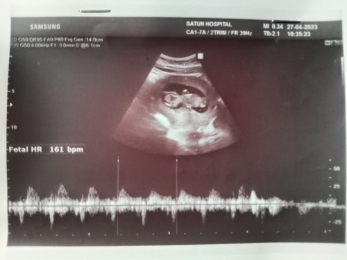 ปรึกษาแม่ๆหน่อยน่ะคะ