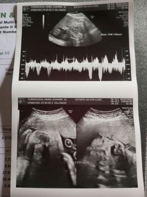 Hello po ask ko lang Po