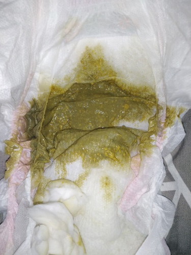 Green ang poops ni baby