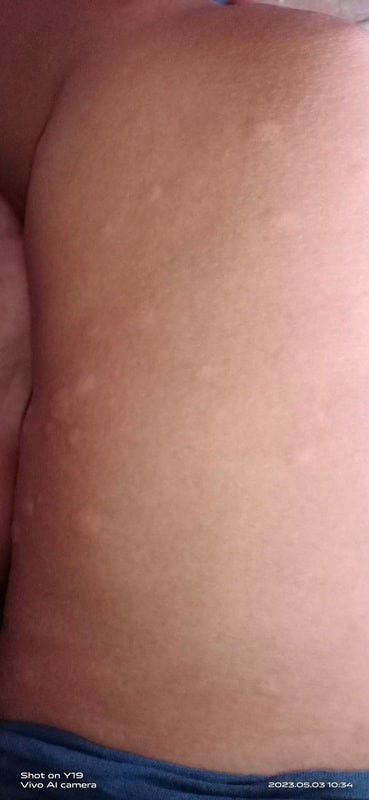 Asking for my question..