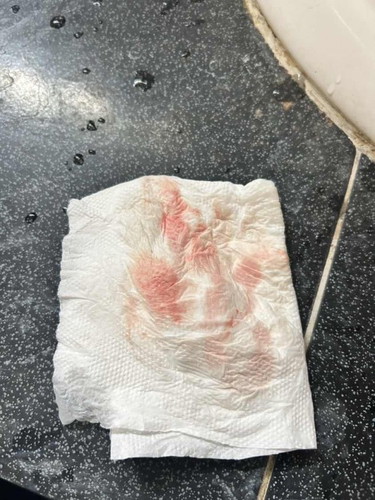 มีเลือดออก🥲🥲🥲☹️