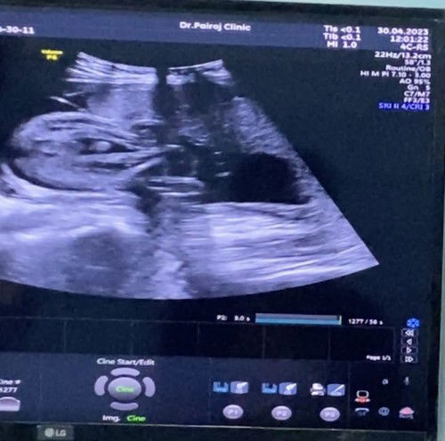 แบบนี้เพศ ญ หรือ ช คะ?