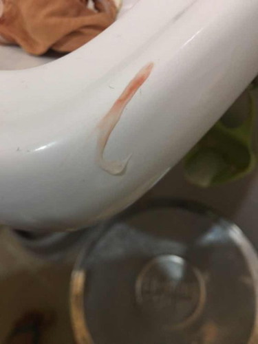 mucos plug na po ba ito?