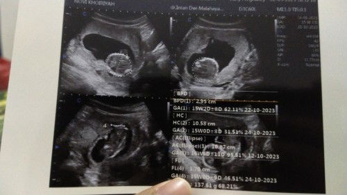 Bun sharing dong yg udah pada pengalaman