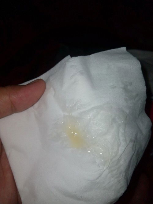 Lendir bening agak kuning