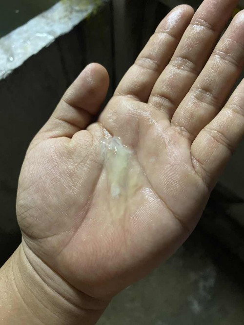 แบบนี้ใช่อาการเตือนไหมคะ