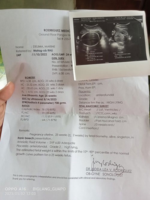 25 weeks & 5 days napo ako