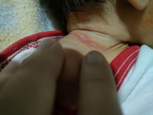 Ano ba gagawin ko dito mami para gumaling?