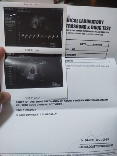 NO HEART BEAT TO HEAR IN FETAL DOPPLER