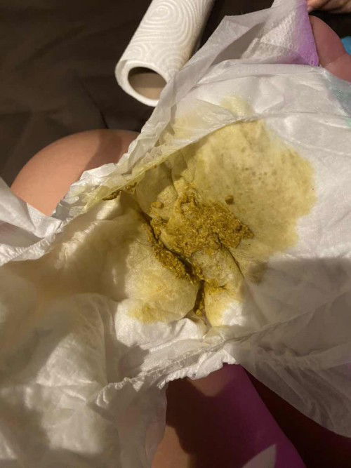 ลูกอายุ 7วัน ถ่ายสีเขียว