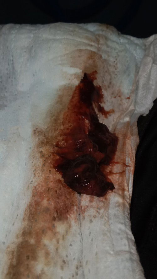 มันคืออะไรคะ