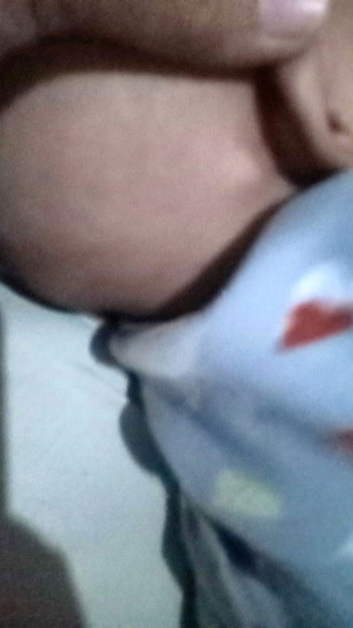 Bayi jarang pup dan ad benjolan d blkg telinga