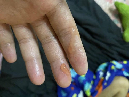 37+4 วีค ปวดท้อง มีมูก