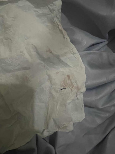 Mengeluarkan flek serelah hubungan badan