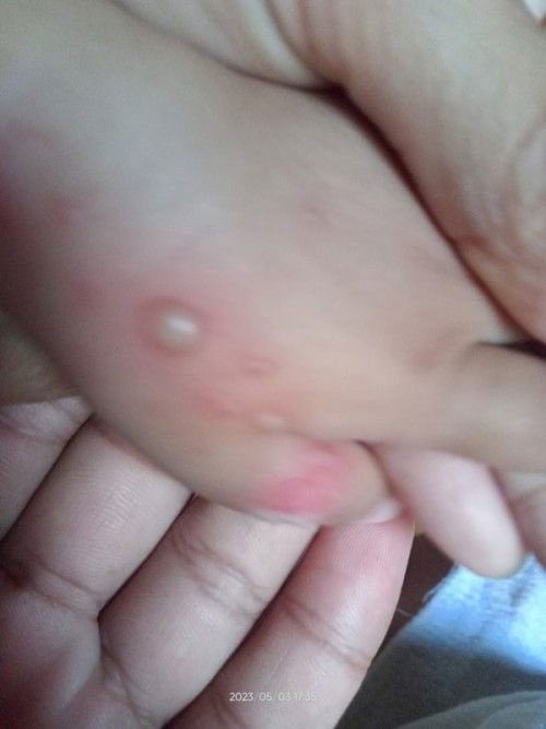 Hello mga mi. Sino po dito nakakaranas ng ganito sa baby po nila?ano po kaya ito?