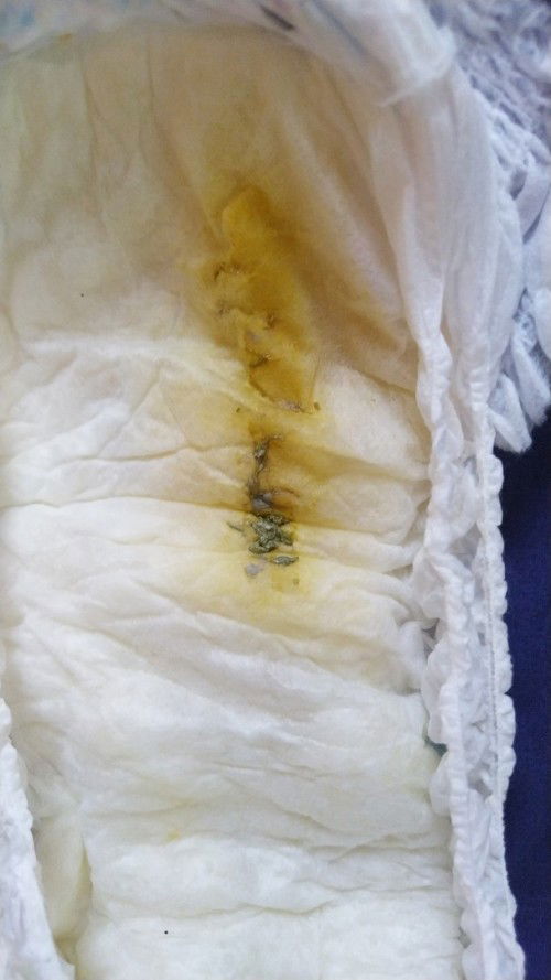 Bunda mau tanya eek anak saya kog sepeti ini kenapa ya ?