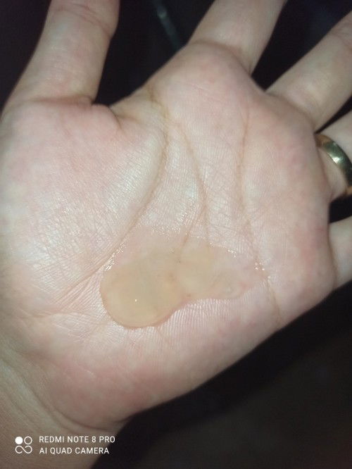 Lendir bening kekuningan