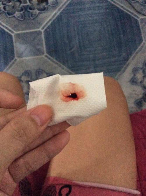 bloody show ba to 39weeks and 4days