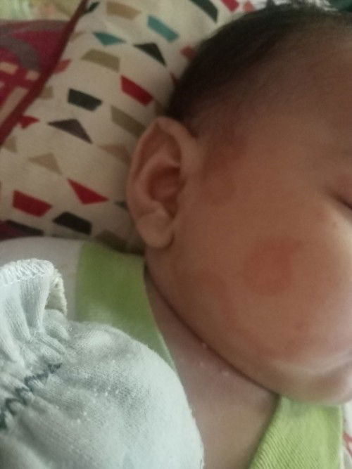 Hawatir banget deh bun