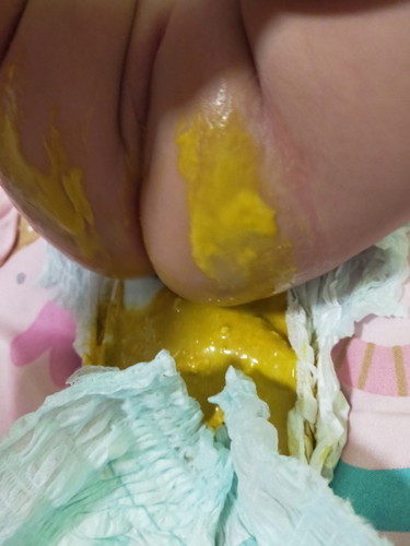 Poop ni baby at 4 months old