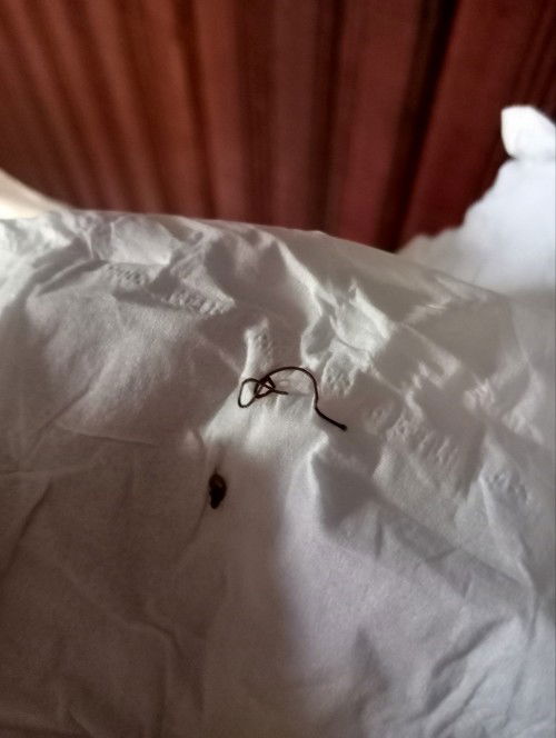 Jahitan pasca melahirkan normal