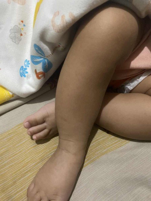 Kaki bayi 4 bulan