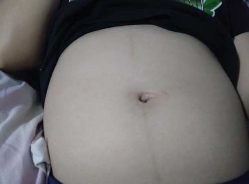 Baby bump