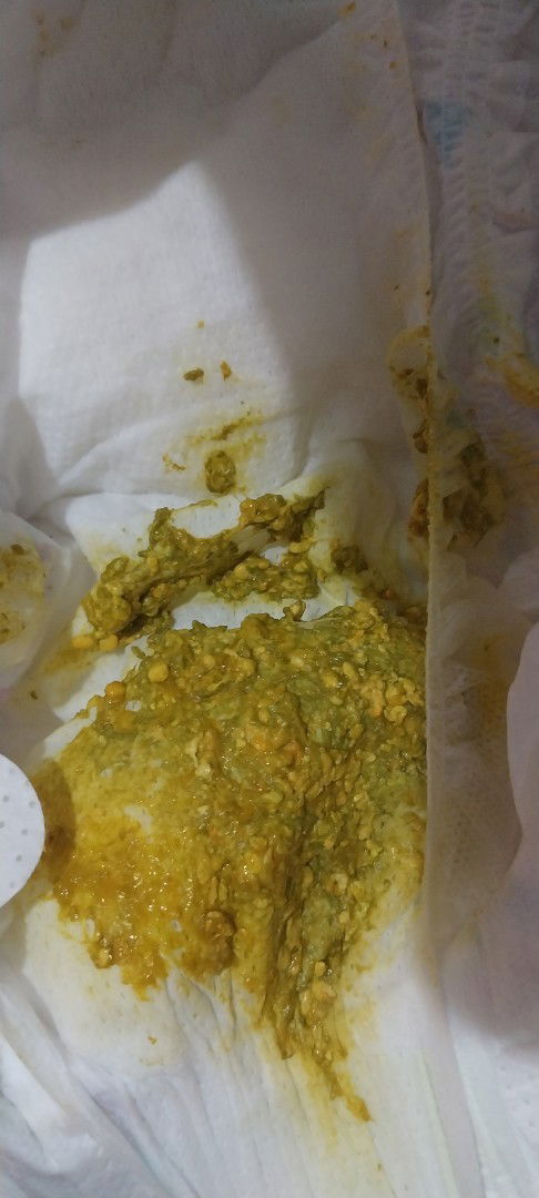 Bé nhà em 1th7d đi ngoài như này có phải sống phân  k ah