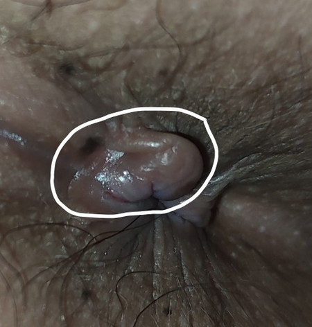 After Birth