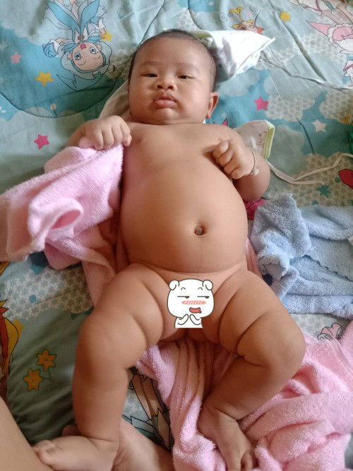 อยากสอบถาม ภาวะ Overfeedihq