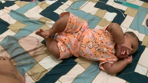 Usia anak  mau 4 bulan belm bisa tengkurep